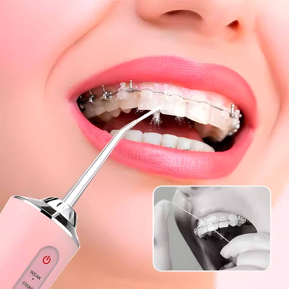 JetDent™ Irrigador Bucal