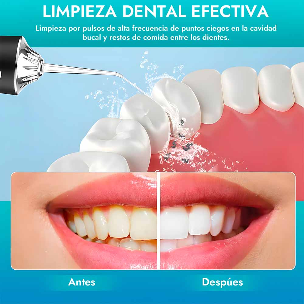 JetDent™ Irrigador Bucal