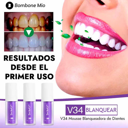 SmileKit™ Blanqueador Dental