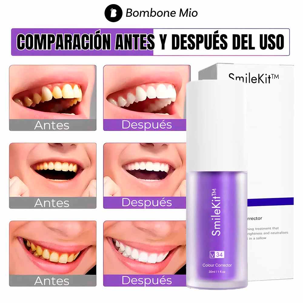SmileKit™ Blanqueador Dental
