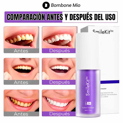 SmileKit™ Blanqueador Dental