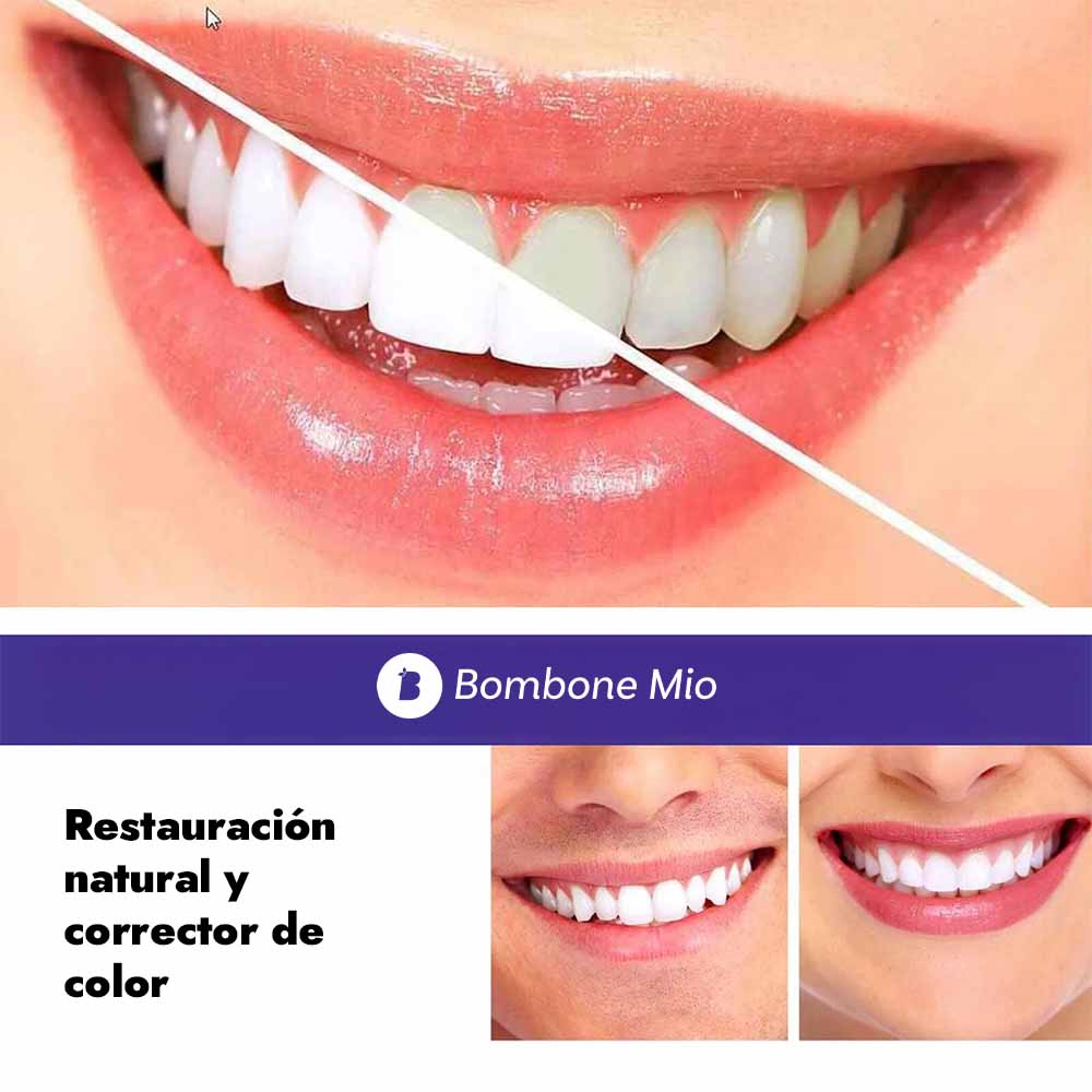 SmileKit™ Blanqueador Dental
