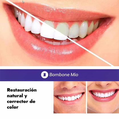 SmileKit™ Blanqueador Dental